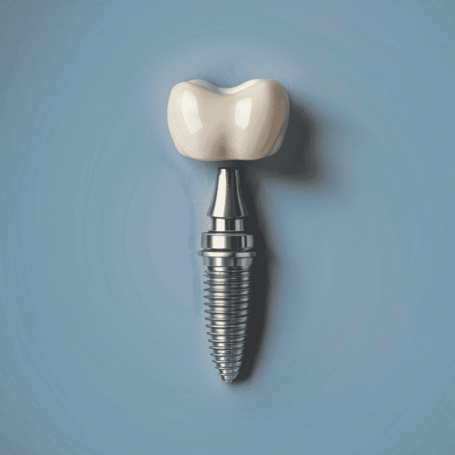 Expertos en Implantes Dentales | Floripa Odontología | Miraflores, Lima, Perú